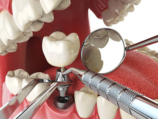 Best After-Hours Emergency Dentist in Buffalo Grove, IL